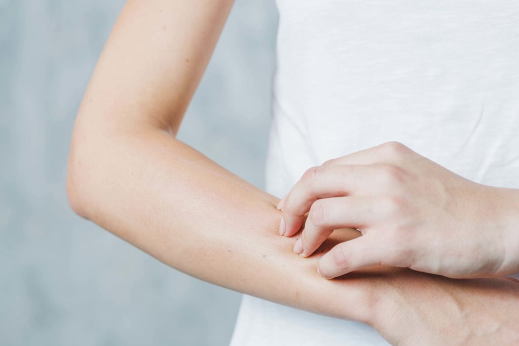peau sèche bras femme - pranaloé boutique de cosmétiques bio en ligne 
